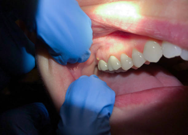 Best Emergency Denture Repair in South Valley, NM